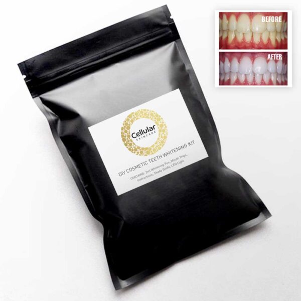 DIY Cosmetic Teeth Whitening Kit - Image 2